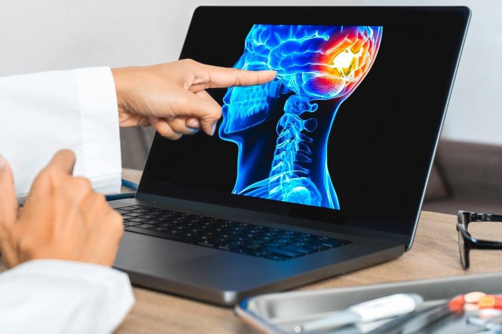A hand pointing to a laptop screen showing an anatomical illustration of a human head